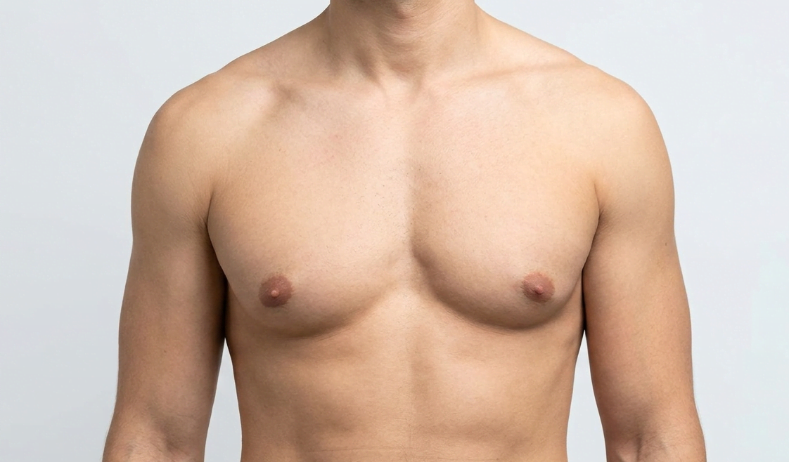 Gynaecomastia